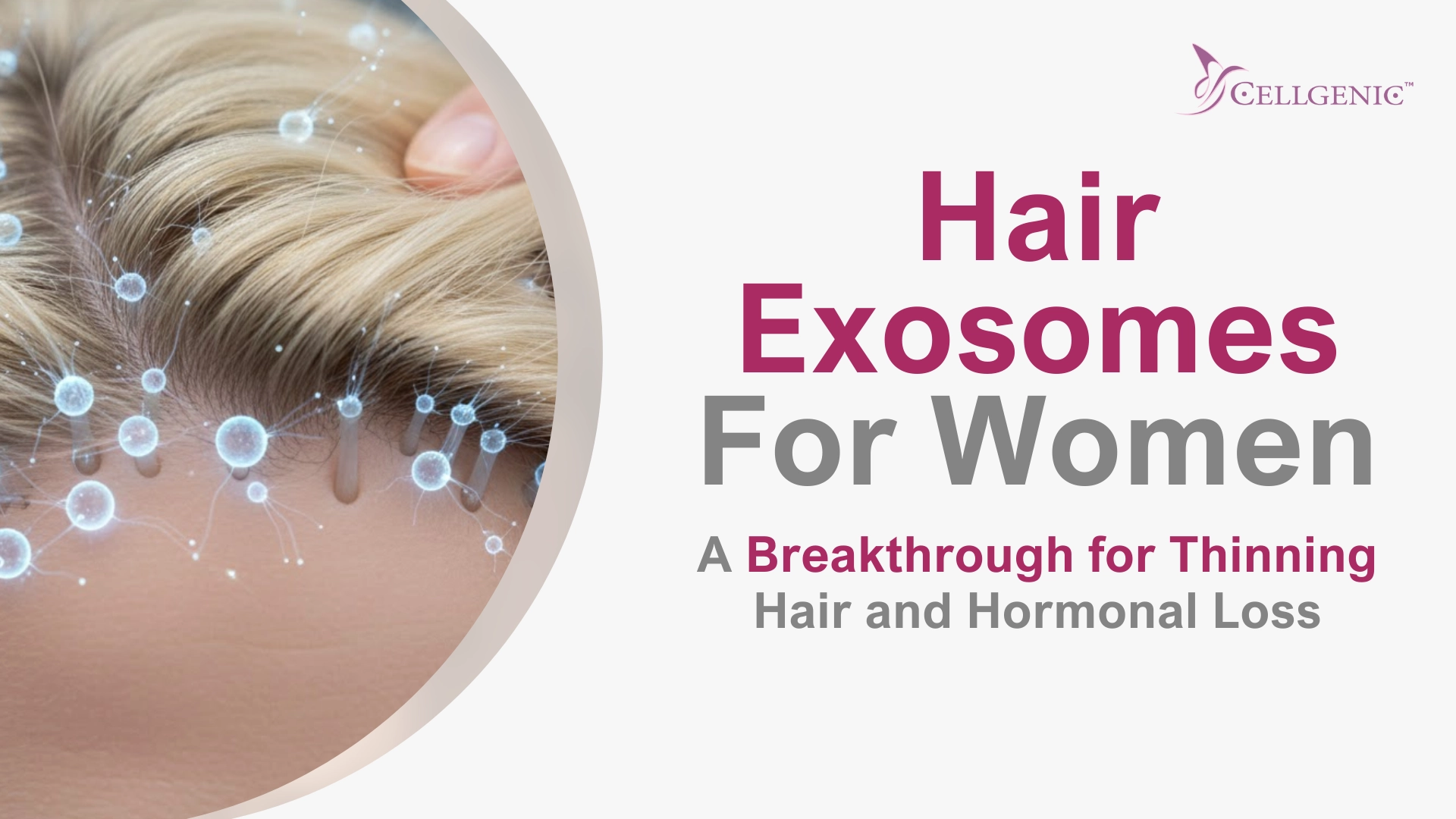 Microscopic illustration of hair exosomes stimulating hair follicles for female pattern hair loss